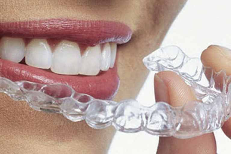 Invisalign